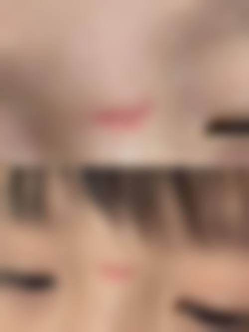 增生疤痕变白的过程是怎样的