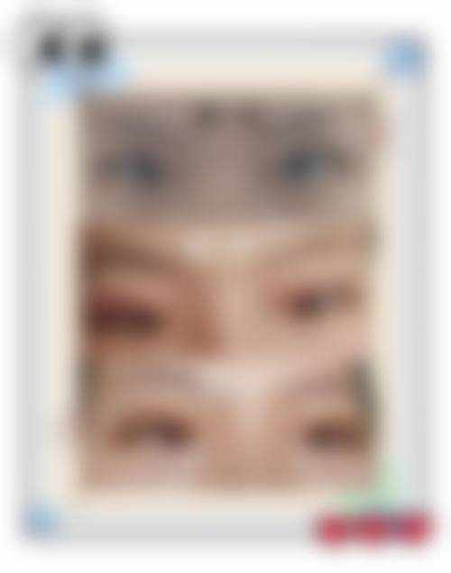 手术成效与哭肿关系