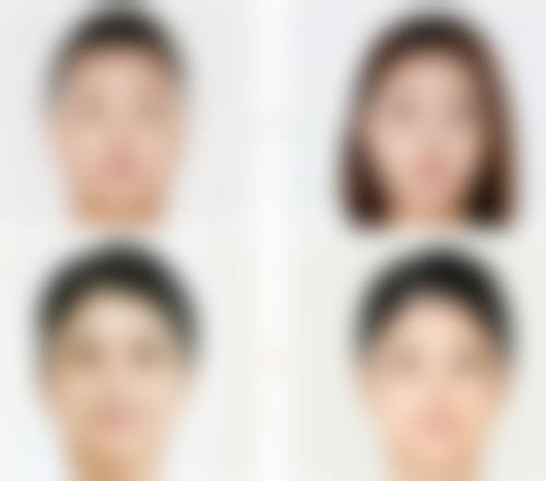 圆脸适不适合打瘦脸针，判断方法在这里