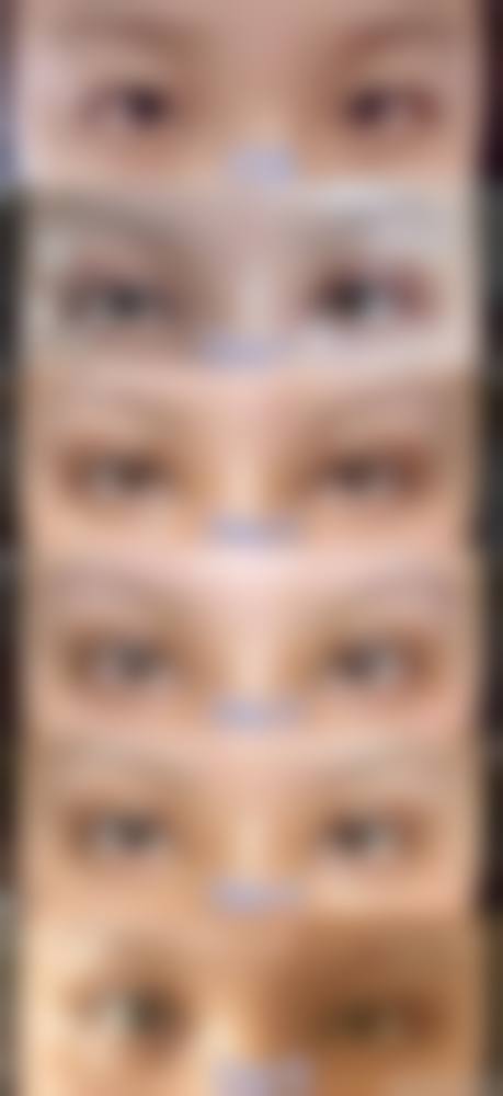 选择正规医院医生，保护手术成效