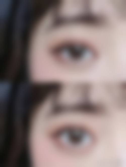 影响手术成效的因素及应对方法