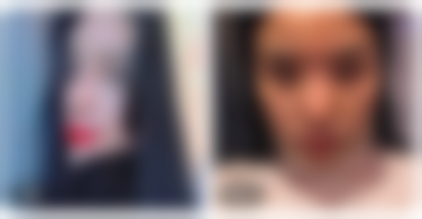 厦门脸博士整形外科门诊口碑好评反馈