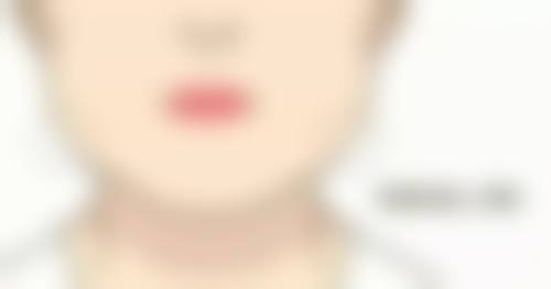 未成年医美避坑：家长该如何引导孩子树立正确审美