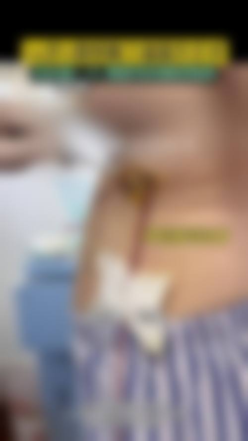 隆胸取出假体本身能解决什么、不能解决什么？