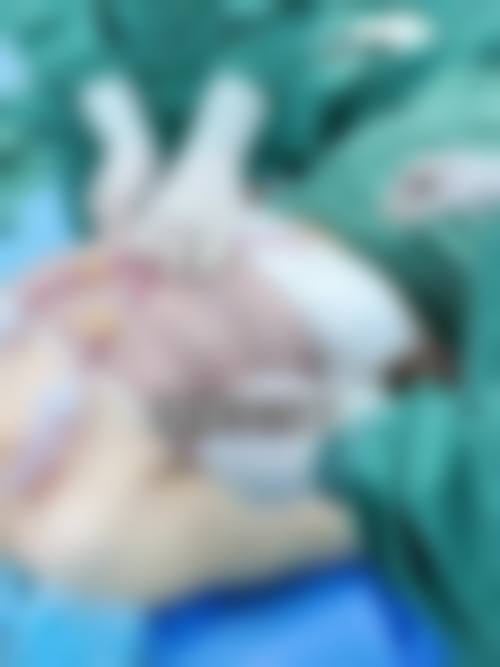 从医学角度看，隆胸取出假体的风险主要集中在哪些环节？