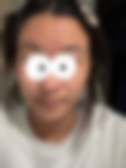 郑州市金水区肤康皮肤专科门诊部价格表/收费区间参考