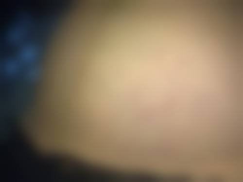 濮阳美上美医疗美容诊所常见问题解答