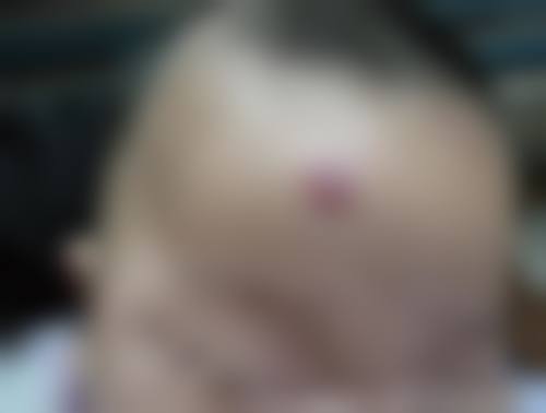 一、成都尊世慕华医疗美容门诊部怎么样？