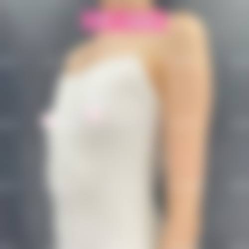 隆胸手术的医院医生怎么选？