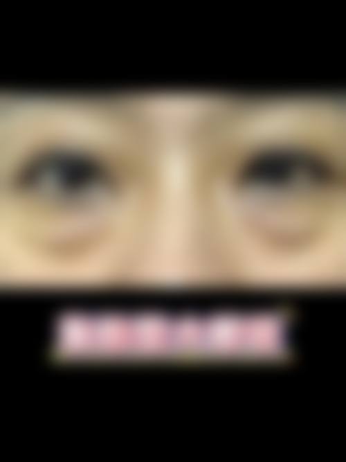 鸡蛋去眼袋多久能好？通常坚持1 - 2个月改善眼袋，原理、方法全揭秘！ 