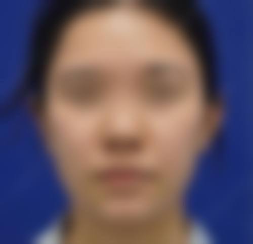 重庆解放军三二四 医院整形美容中 心价格表