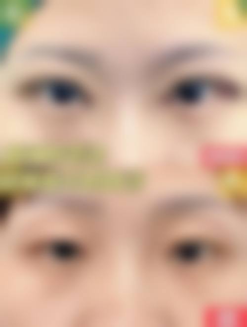 鸡蛋去眼袋本身能解决什么、不能解决什么？