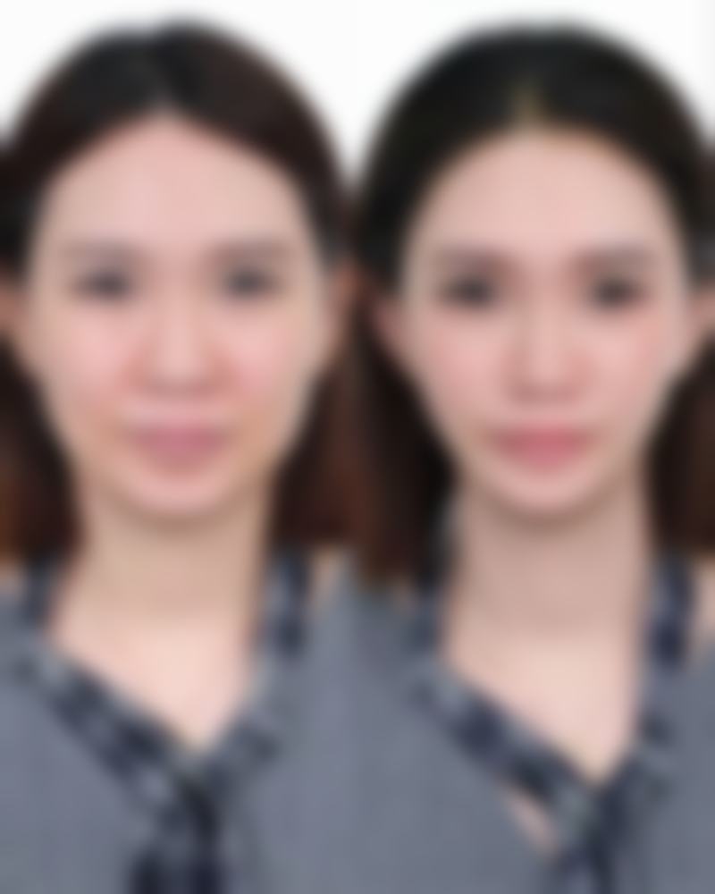 毛发种植技术是怎么出现的（来源与背景）