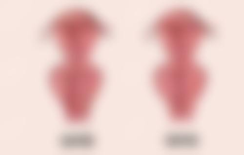 眼袋红肿用什么药消肿好？