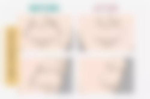 眼袋红肿痛怎么办？局部用药方案全揭秘