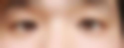 定位双眼皮取线的价格是多少？