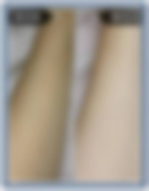 先自我筛选适配性，面诊是决策的关键一步