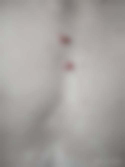 多肽修复疤痕真的有效吗？答案是肯定的！它刺激细胞再生促胶原合成加速修复 