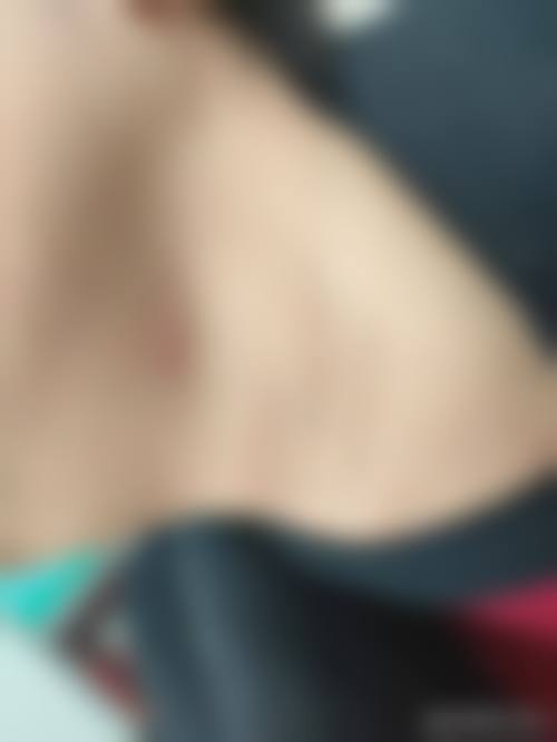 多肽促进疤痕修复是什么？通常在什么医学背景下被选择？