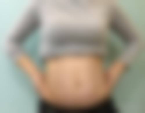 三、长沙申美医疗美容医院正规靠谱吗