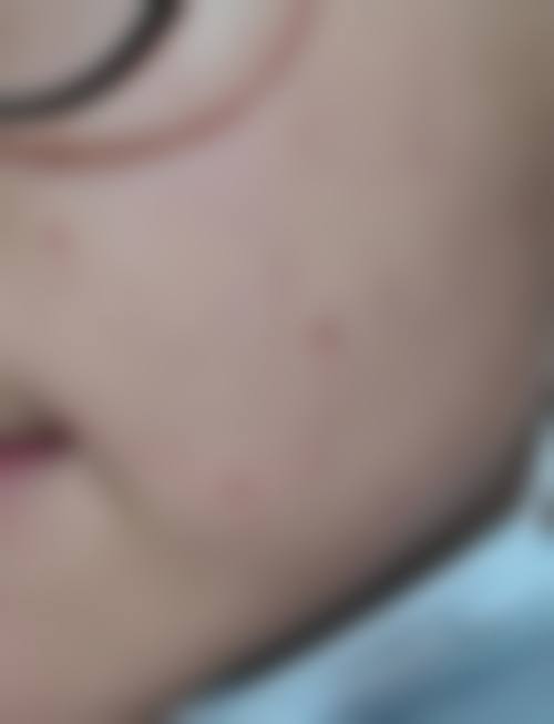 佛山广文皮肤科医院是正规医院吗？正规资质查阅：