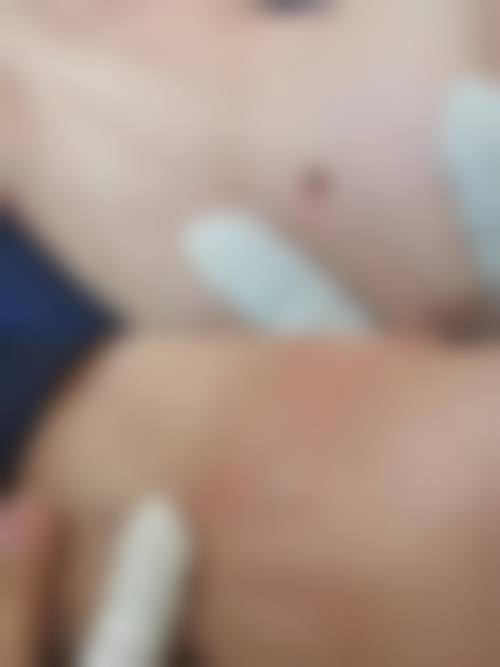 患者常见问题解答（精选 ）