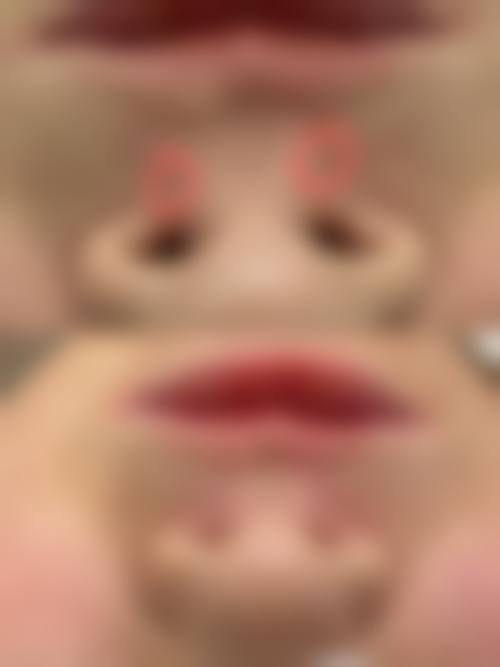 佛山广文皮肤科医院重点诊疗项目及技术优势