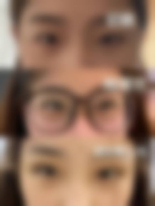 总结：怎么做能变双眼皮？手术、贴双眼皮贴、按摩等方法，总有一款适合你！