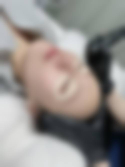 去除黑眼圈和眼袋方法的来源与背景