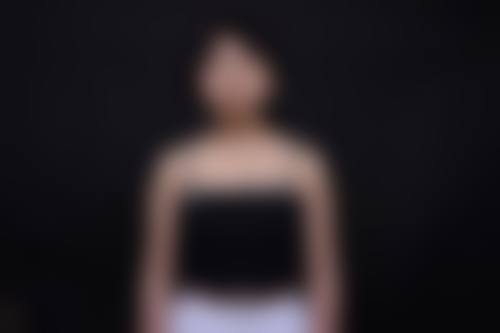 穿戴合适内衣，为术后胸部撑起“保护伞”？