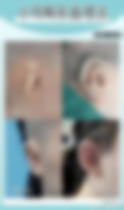 佳木斯大学附属医院整形美容科价格表