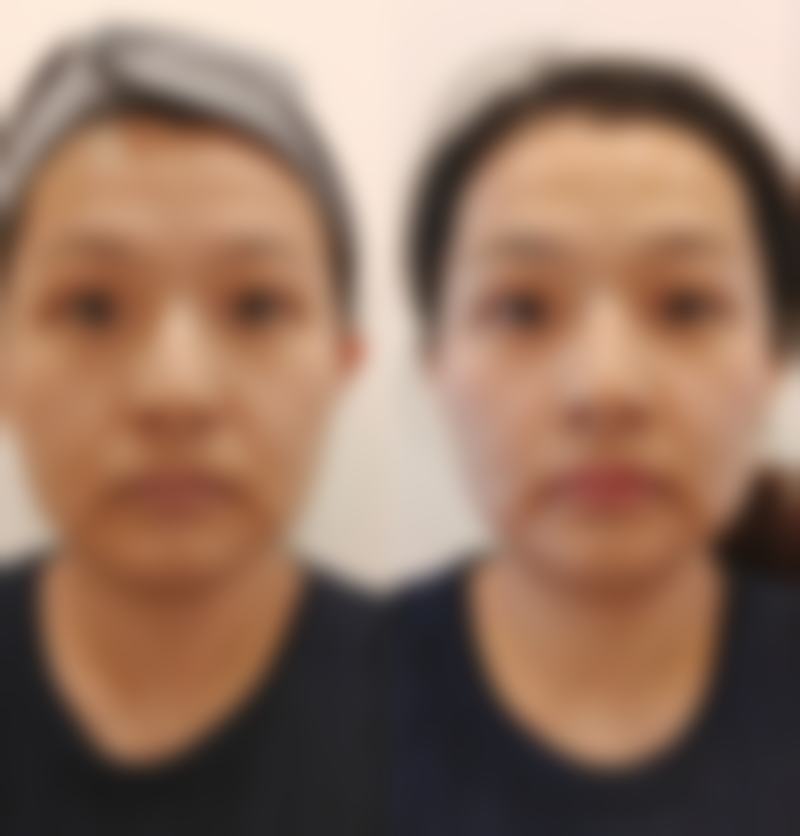 选择金哲医生注射需要注意什么?避坑指南请收好!