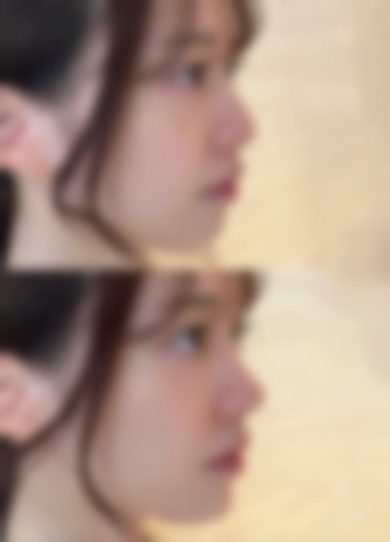 佳木斯大学附属医院整形美容科疤痕整形技术优势