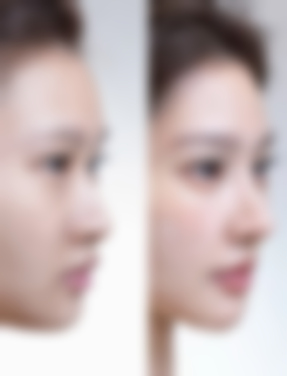 浙江省医美在线询问预约攻略！悦可医美这样预约更效率高！