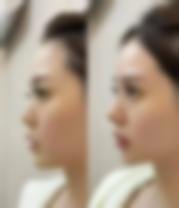 手术引流怎么选择医院医生及国内医院医生推荐