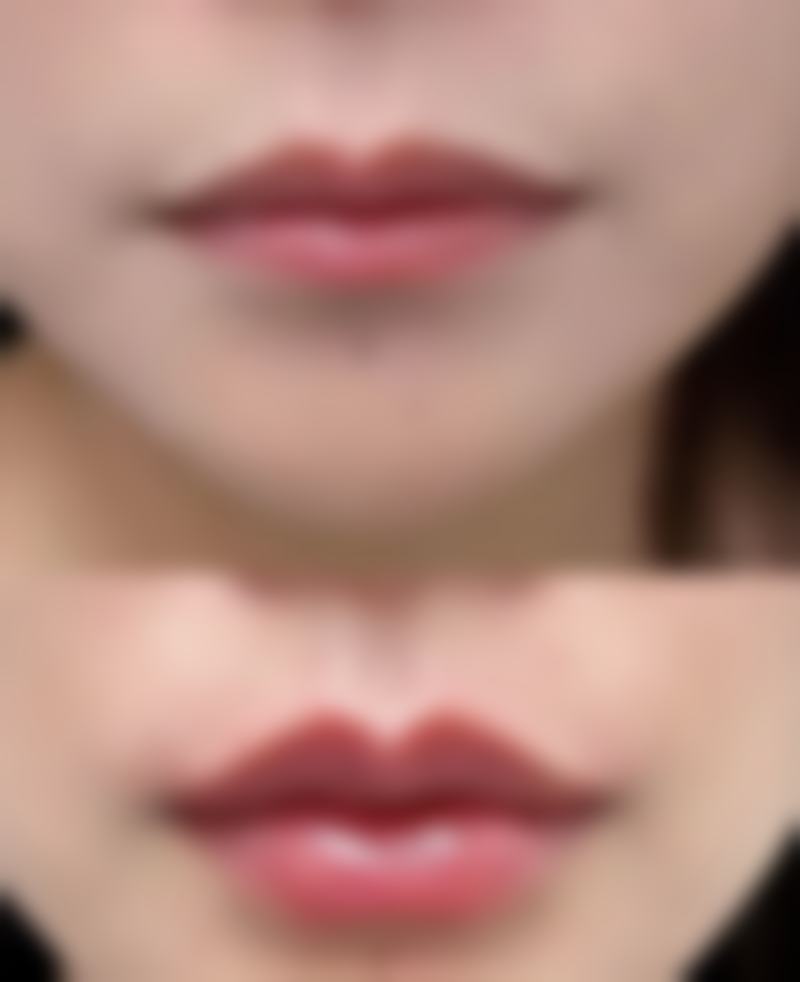 青岛瑧妍美医生团队怎么样?金哲医生口碑评价如何?