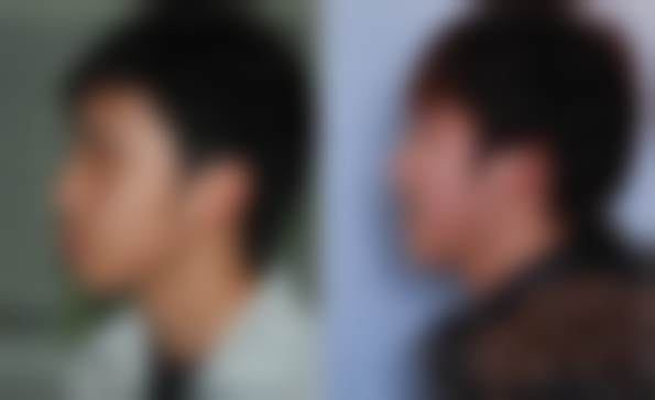 六、广州时光整形美容医院价格表参考