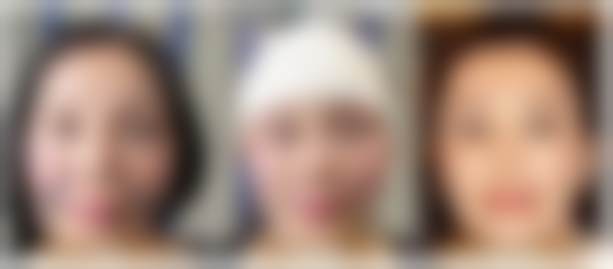 二、广州时光整形美容医院是正规医院