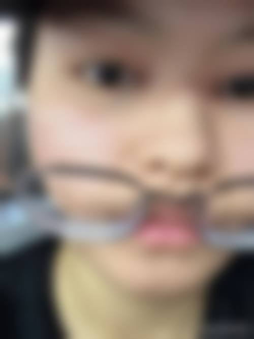 医生在判断滚蛋美容去眼袋成效边界中的作用