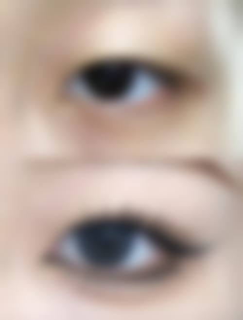 如何为滚蛋美容去眼袋设定一个合理且可验证的成效目标