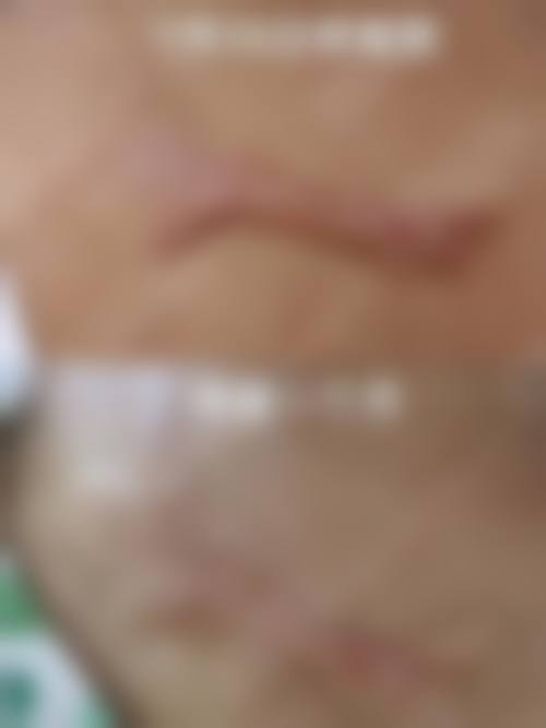 韩国SMALLFACE整形外科医院重点特色诊疗项目