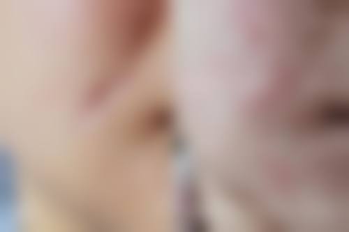 抓的疤痕如何快速修复？巧用3种方法，搭配2类护理，快速淡化不是梦！——哪些不可控因素会拉长修复时间