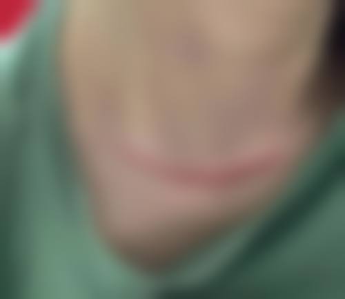 成都俏百颜美容整形医院口碑好不好?患者诊室评价