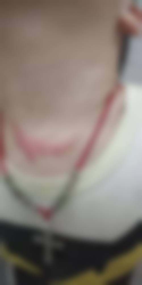 杭州浙一医院整形外科口碑好不好?患者诊室评价