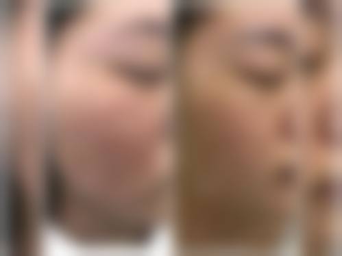 五、武汉微幕医疗美容门诊部特色技术及诊疗优势