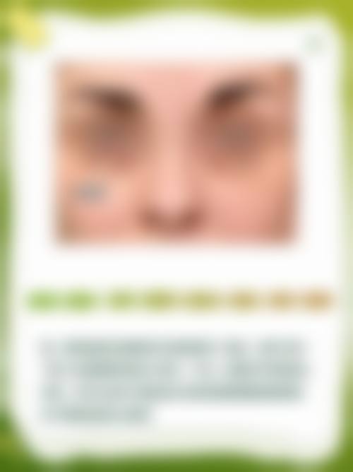 二、女性眼袋大怎么改善？调整作息+眼部按摩+医美手段，三管齐下超有效！通常在什么阶段被纳入医疗选择范围？