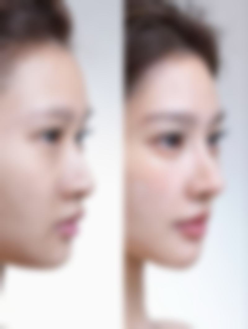 三、田聪儿医生做手术价格: