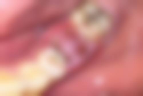 杭州靠谱医美机构设备大比拼:谁的皮肤美容设备更精良?