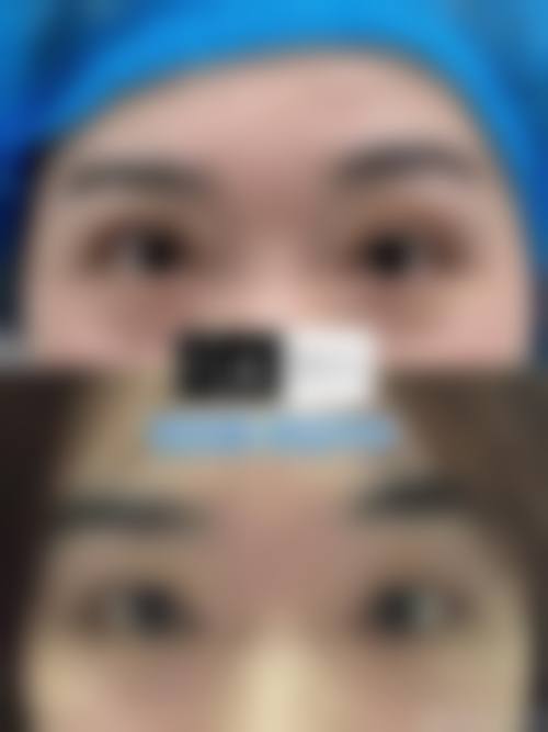 如果成效不理想，是否有补救与修复空间