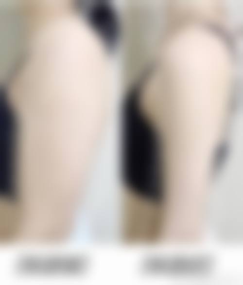 医生在判断安心吸脂成效边界中的作用